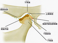 顎関節症とは?〜痛み〜