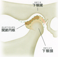 顎関節症とは?〜顎関節あたりで音がする〜